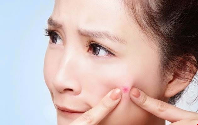 Bạn có nên nặn mụn ẩn