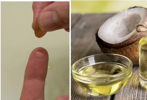 Dùng vitamin E thôi chưa đủ, kết hợp với 4 nguyên liệu này sẽ có da trắng không tì vết